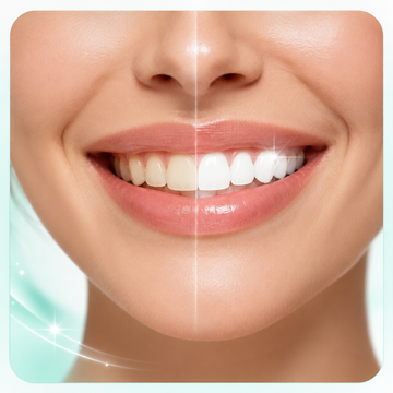 Brighter-Looking Smile